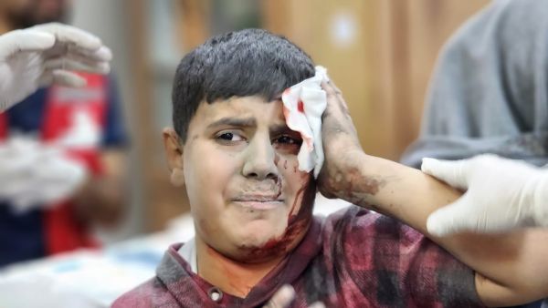 عدوان متواصل منذ 20 يوما على القطاع 