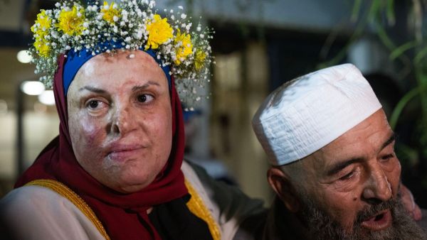 الأسيرة الفلسطينية المحررة إسراء الجعابيص