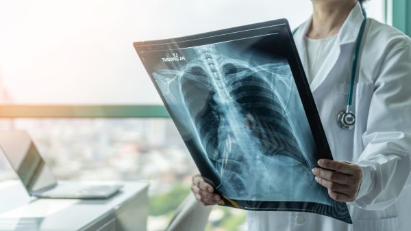 undiagnosed pneumonia