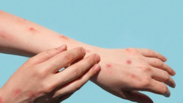 virus 