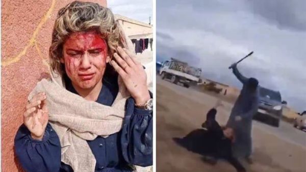 ضرب فتاة وشقيقتها في الرقة 