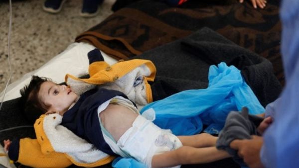 أطفال غزة يموتون جوعا