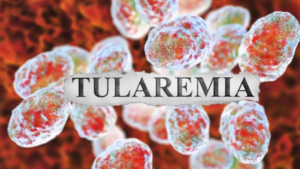 Tularemia disease. (Shutterstock/ edited by Al Bawaba) Tularemia disease