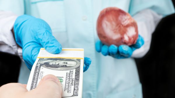Organs