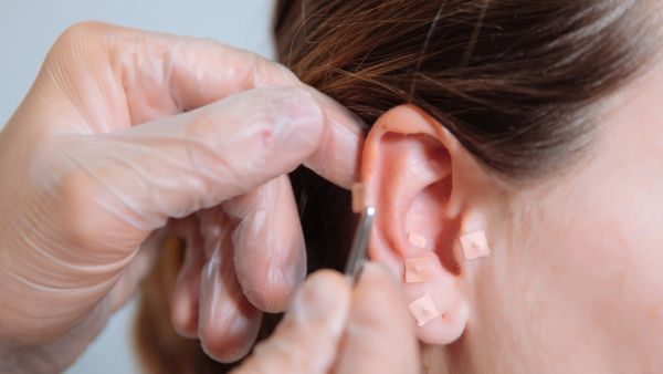 طبيب البوابة: العلاج بالمغناطيس لتخفيف الوزن