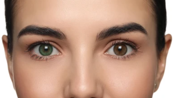 Eye color 
