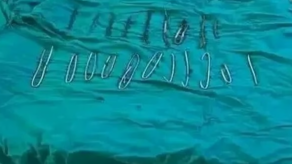 إخراج 20 مسمارًا وأسلاكًا معدنية من بطن مريض في الجزائر إخراج 20 مسمارًا وأسلاكًا معدنية من بطن مريض في الجزائر