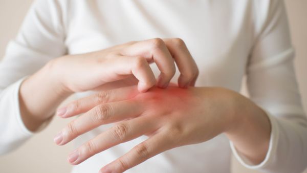 Shutterstock skin allergies