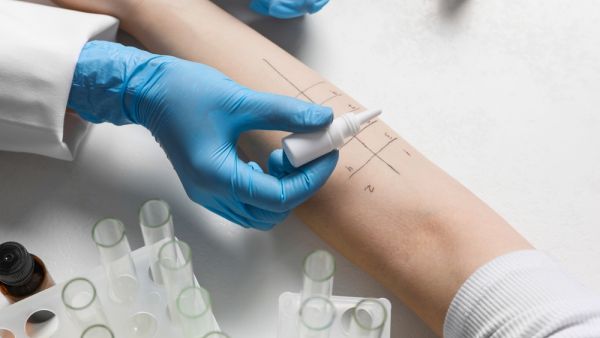 Shutterstock World allergy week