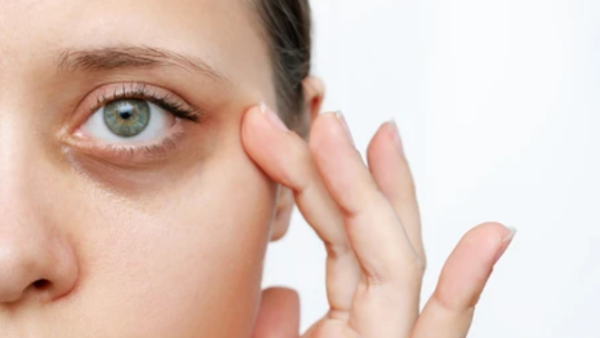 Shutterstock dark circles