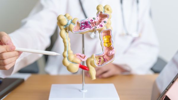 Shutterstock colon cancer