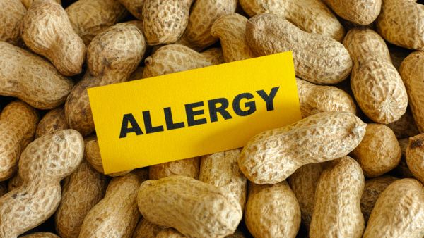Shutterstock food allergies