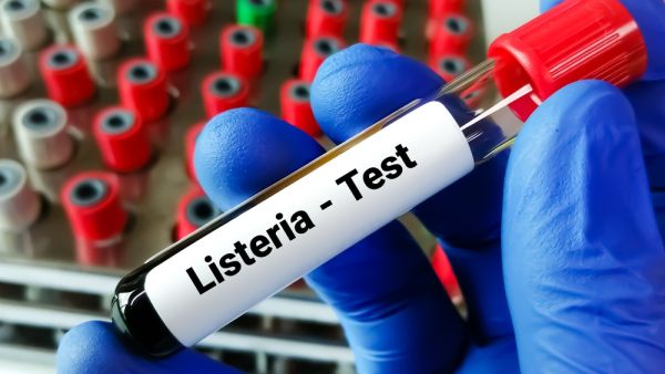 Shutterstock Listeria