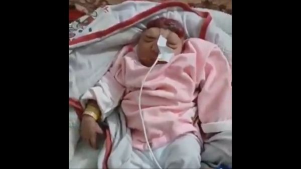 Video: Baby born without brain amid surge in birth defects in Gaza