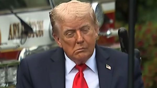 "Trump Is Dying:" White house dismisses photos as minor vein problems