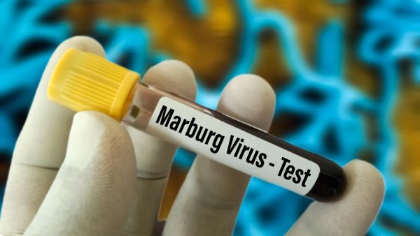 فيروس ماربورغ