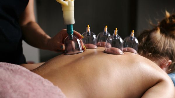 أشياء يجب تذكرها عند إجراء الحجامة