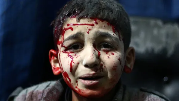A file photo taken on February 02, 2015 shows an injured Syrian child waits for treatment at a makeshift hospital in the rebel held area of Douma, north east of the capital Damascus, following reported air strikes by forces loyal to President Bashar al-Assad. (AFP/Abd Doumany)