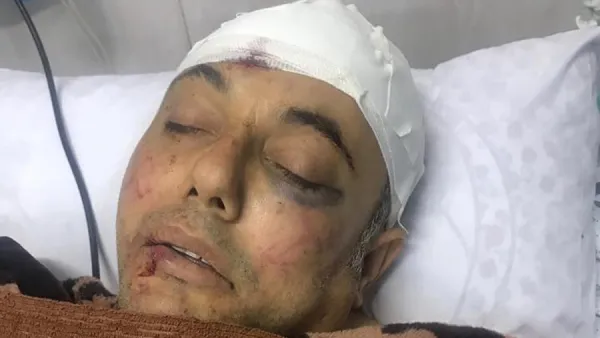 مصادر طبية: وضع أبو سيف خطير، وأنه يخضع لفحوصات طبية وصور طبقية في رأسه 