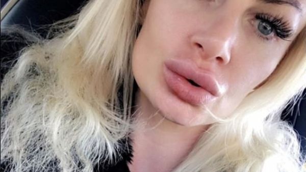 (Kerry Miles/ Instagram)