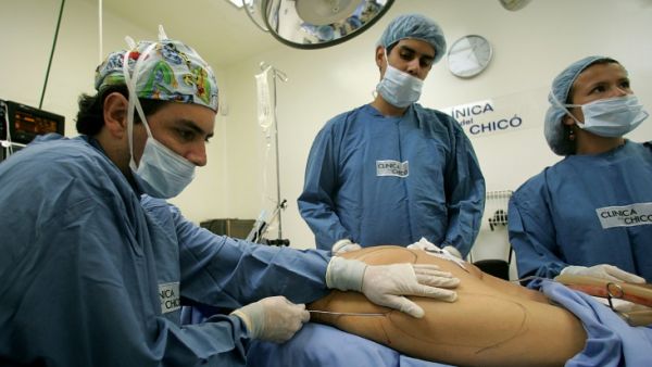 Liposuction remains the second most popular surgical procedure after breast augmentation (AFP/File Photo)	