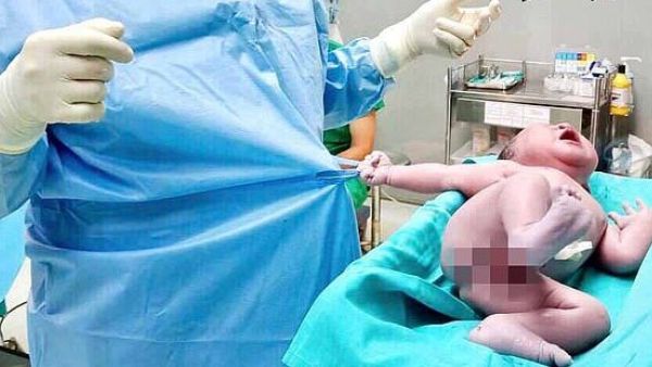 This is the adorable moment a newborn baby boy grabs hold of a doctor's shirt and refuses to let go after just being born (dailymail.co.uk)