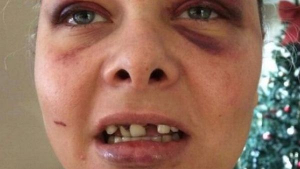 Lois Ashton (Twitter)