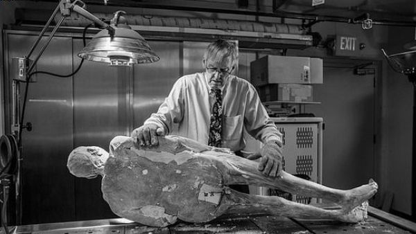 When Sue first volunteered herself, Dr Vic Spitzer said no, because of her various complications, including her hip replacement. Eventually he agreed, but it did mean some posthumous logistical acrobatics (Twitter)