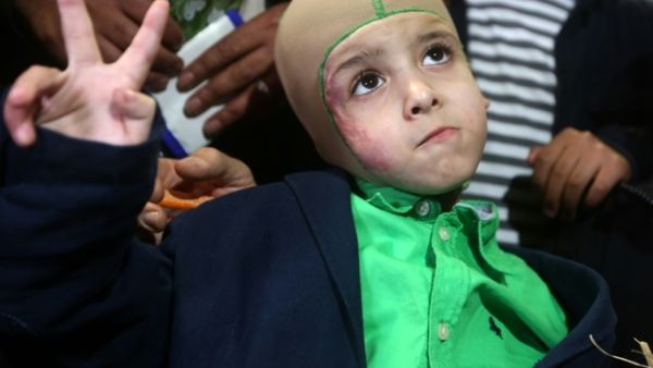 Five-year-old Ahmed Dawabsha, a Palestinian boy who survived a firebombing by Jewish extremists, in the northern West Bank city of Nablus on March 15, 2016. (AFP/File) 
