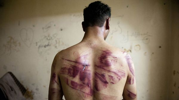 Syrian prisoner tortured by the Assad regime. (AFP/file) 