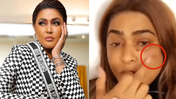Waad was in a very bad psychological state after she discovered the results of a recent plastic surgery she had (Source: sana alsaid - Youtube - waedhanan - Instagram)