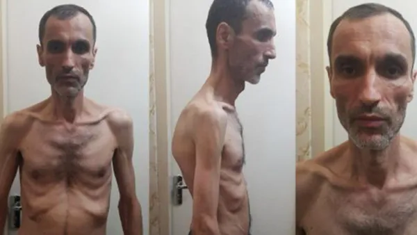 مساعد أحمدي نجاد المضرب عن الطعام ينشر صوراً مخيفة 