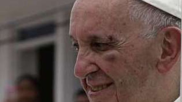 البابا فرنسيس يصاب بوجهه اثر اصطدامه بزجاج سيارته 