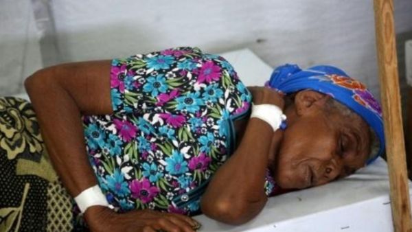 إمرأة تعالج من الكوليرا في مدينة الحديدة اليمنية
