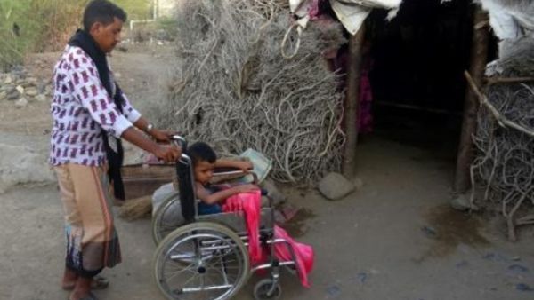 الطفل اليمني عبدالله في كرسي متحرك نتيجة إصابته في انفجار لغم في محافظة تعز في غرب اليمن
