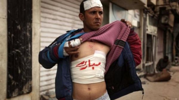 متظاهر مصاب/أ.ف.ب