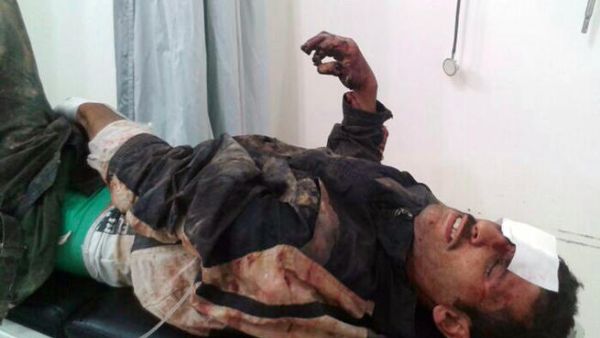 A wounded man is brought to a hospital in the eastern Lebanese city of Baalbek (AFP/STR)