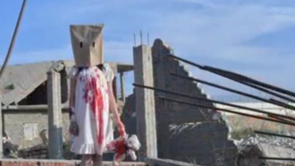 The photos, staged to depict bloodied children in Syria, were taken in an abandoned building near the Suez Canal. (Twitter)