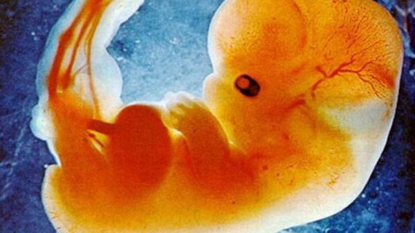 Male fetus rumored to have the ability to masturbate in the womb. (Image: Google)