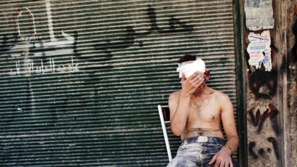 A wounded man sits outside of a shop in Aleppo.  (AFP/File)