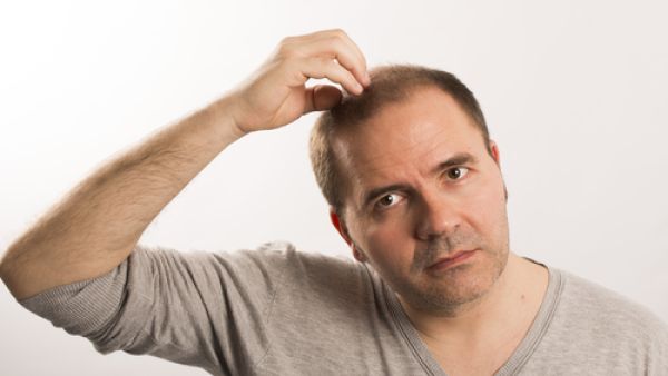 زراعة الشعر أفضل الاقتراحات المتاحة أمام من يريد التخلص من مشاكل الشعر 