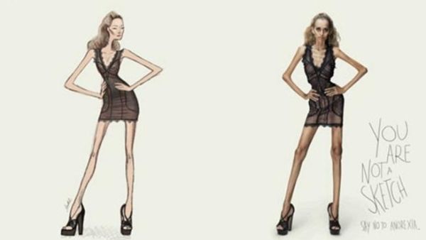 اعلان وكالة ستار موديلز المناهض لانروكسيا عارضات الازياء