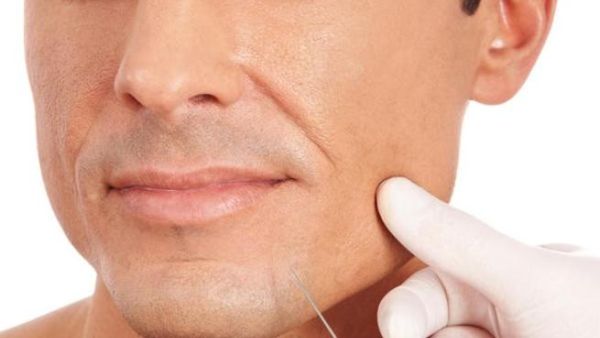 أنت لست بحاجة الى عملية تجميل للحصول على ذقن قوي