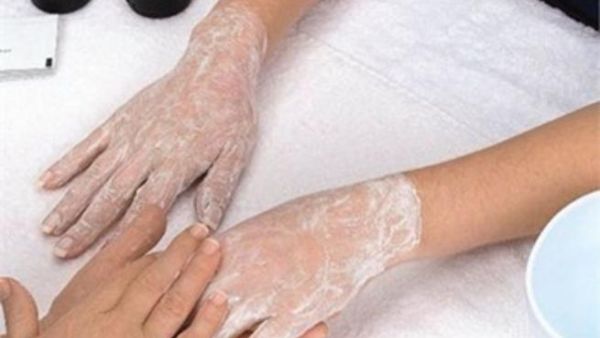 صورة تعبيرية 