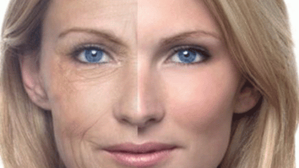 الإصابة بالشيخوخة.