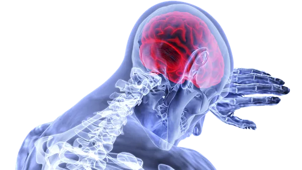 9 حالات من كل 10 من مرضى السكتة الدماغية تكون الجلطة هي السبب