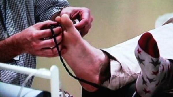 النساء في خطر أكبر للإصابة بالنقرس