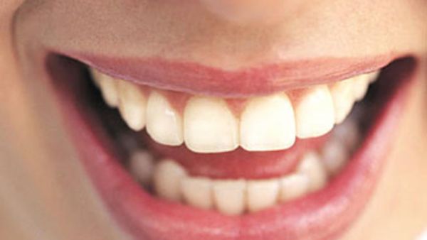 أسنانك المتسخة قد تكون سببا للاصابة بامراض القلب