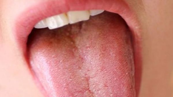 ما تأكله يؤثر على الهواء الذي تزفره. ما تأكله يؤثر على الهواء الذي تزفره.