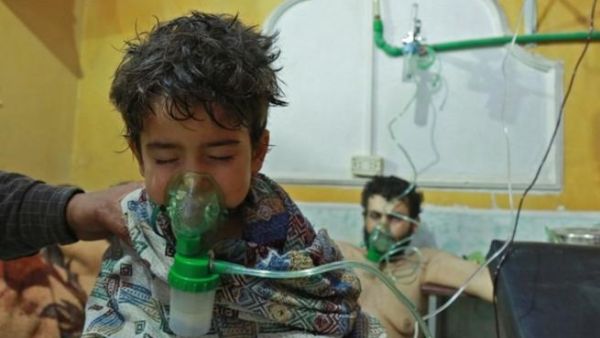 Syrians in a Eastern Ghouta hospital recover from a chemical attack (AFP /FILE)